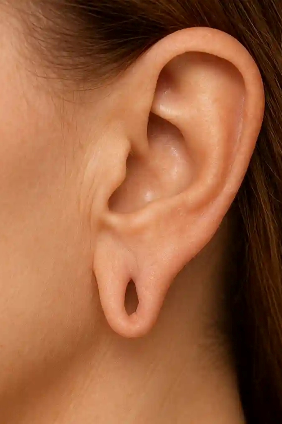 Before earlobe-repair